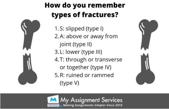 how do you remember types of fractures