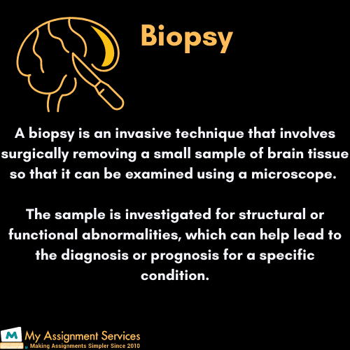 brain biopsy